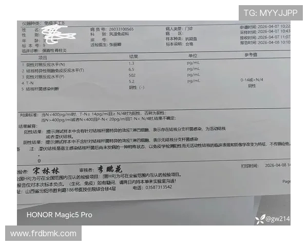 库里MRI检查结果无结构性损伤但右膝肿胀疼痛问题依旧困扰他